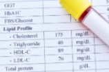 Lipid profile test result with test tube